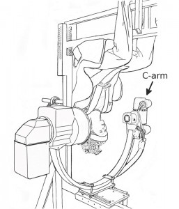 C-Arm with person upside down on it